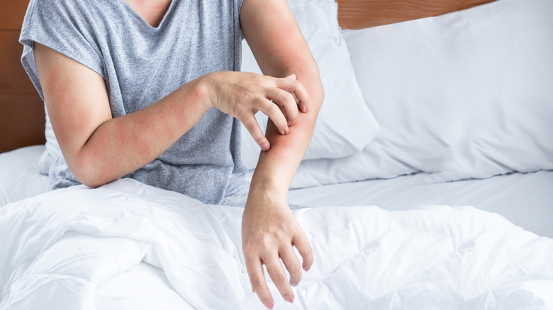 A person scratches their arm while sitting in bed