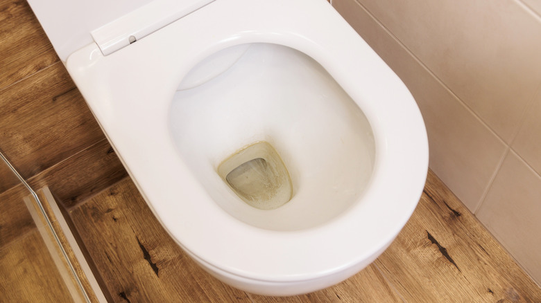A dirty toilet bowl